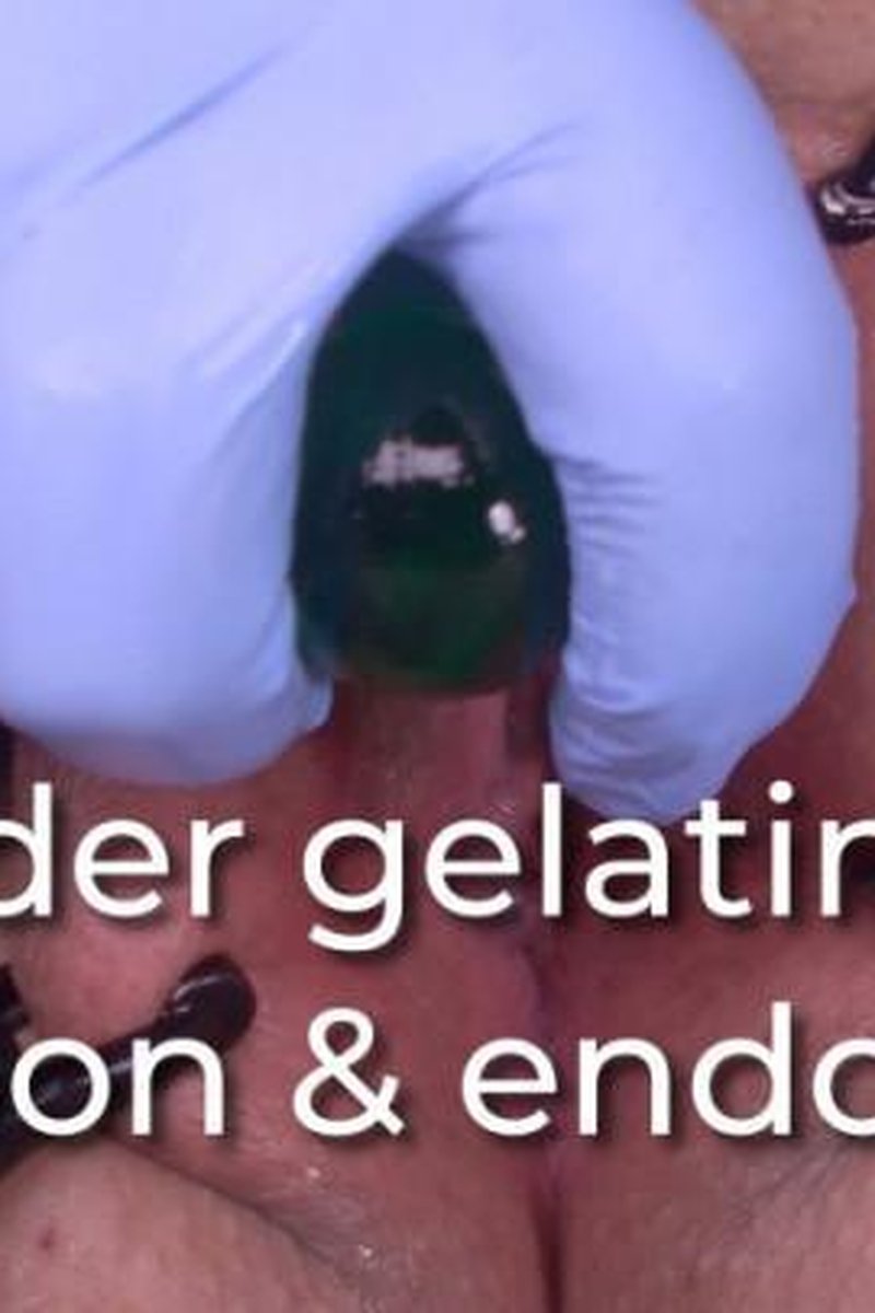 Bladder Gelatin Egg Insertion & Endoscopy - Screenshot 1 of 4 - BDSM