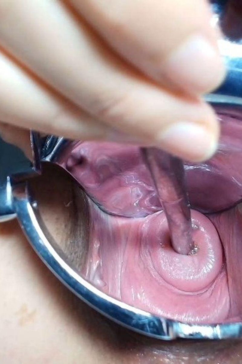 Cervix & Sounding - Screenshot 1 of 4 - BDSM