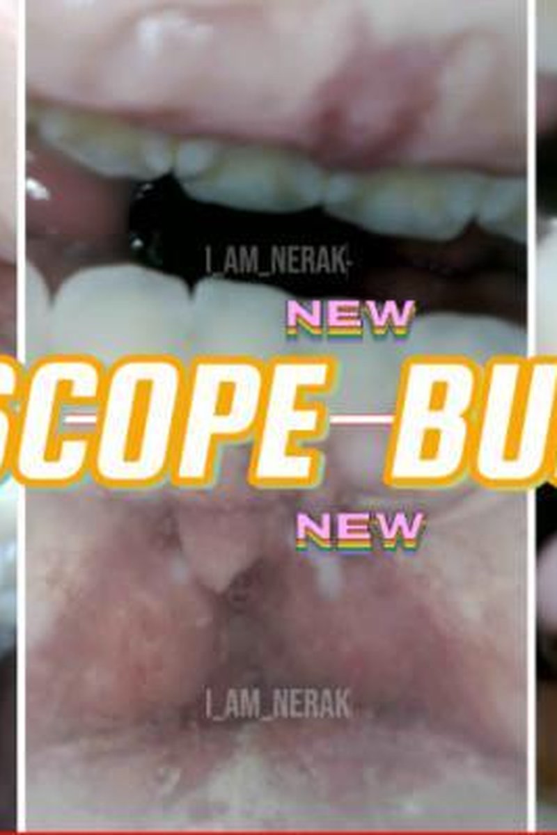 Endoscopy Bubbles - Screenshot 1 of 4 - Endoscopethroat
