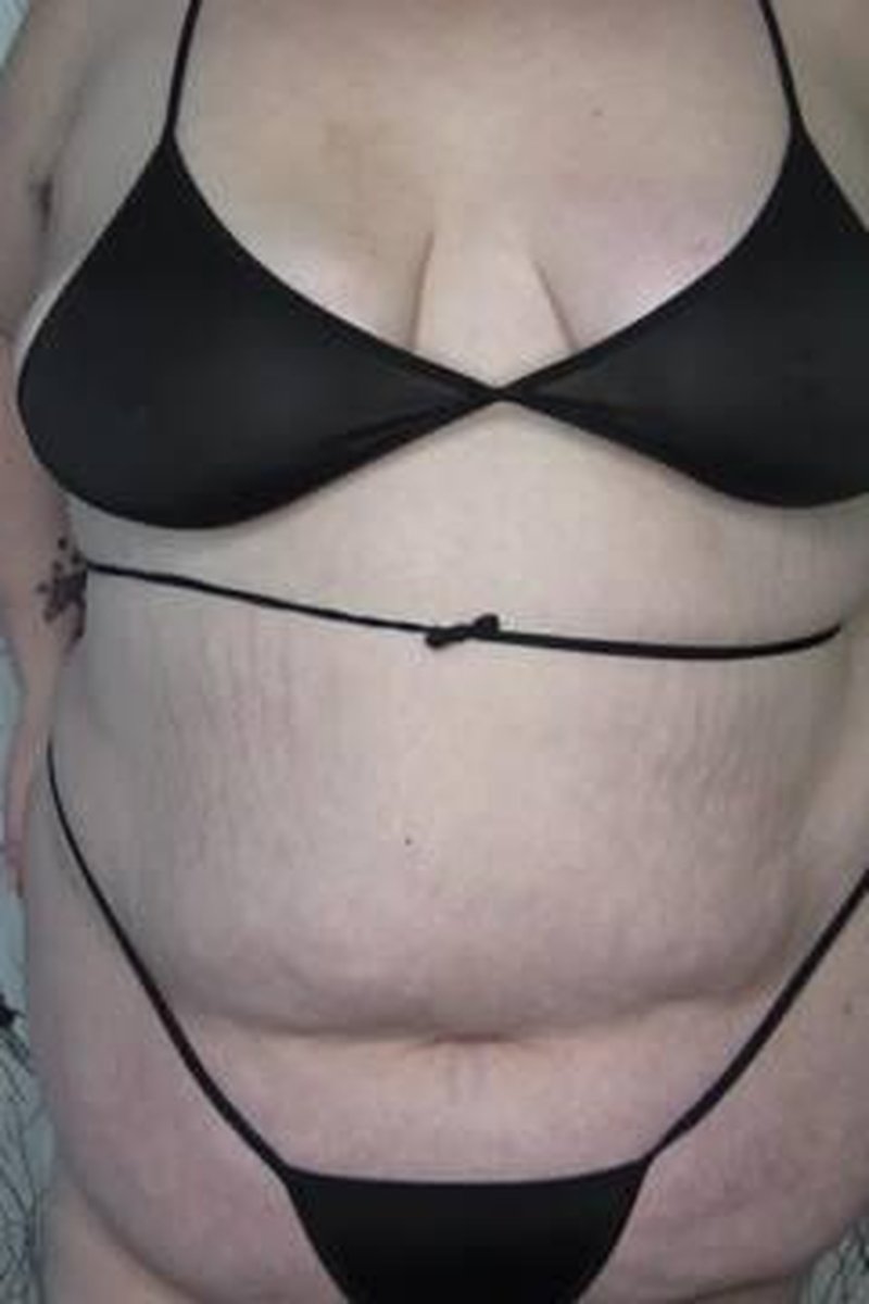 BBW Big Body Tiny Bikini - Screenshot 1 of 4 - Ass Fetish