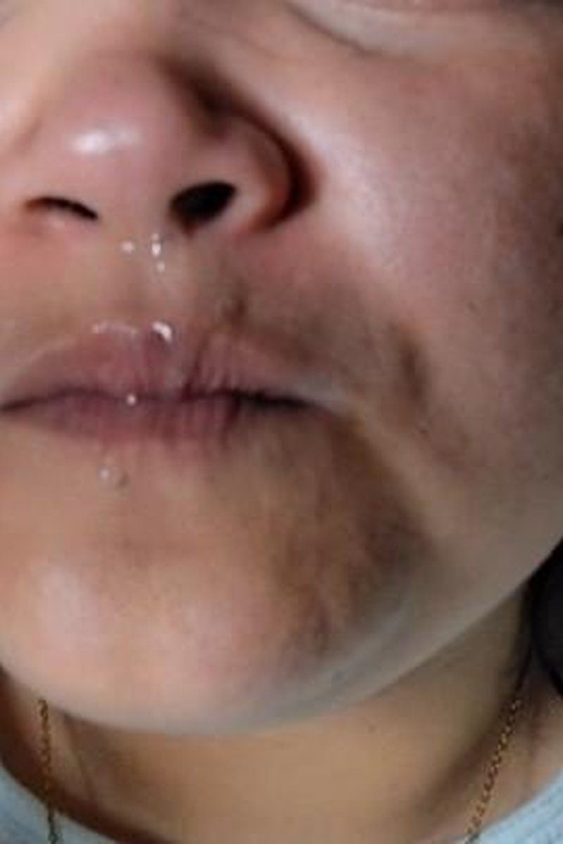 Exploring My Snot - Screenshot 1 of 4 - BBW