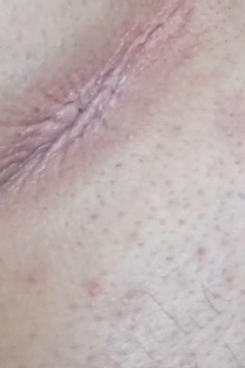 Farting - Screenshot 1 of 4 - Anal