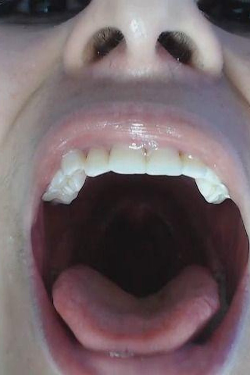 Burping + Mouth Close Up - Screenshot 1 of 4 - Bad Breath