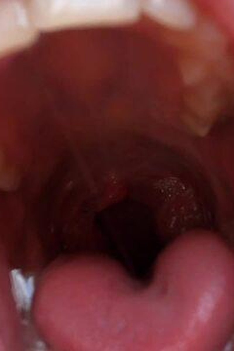 Thaw - Screenshot 1 of 4 - Asmr Licking