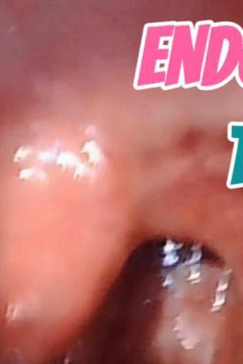 Endoscope Deep - Screenshot 1 of 4 - Endoscopethroat