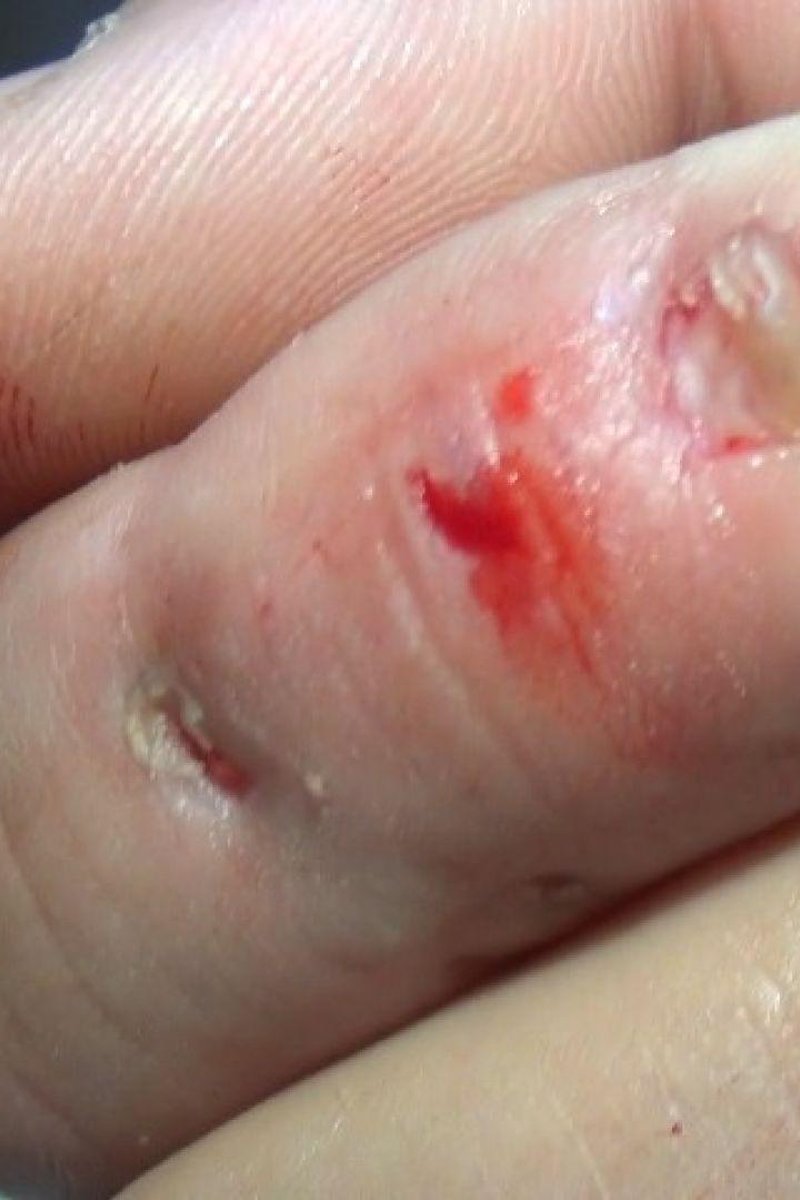Finger Bite 6 - Screenshot 1 of 4 - Biting