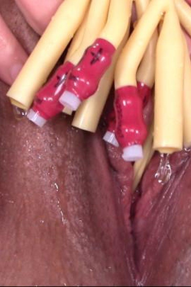 Five Tiny Catheters Dripping - Screenshot 1 of 4 - BDSM