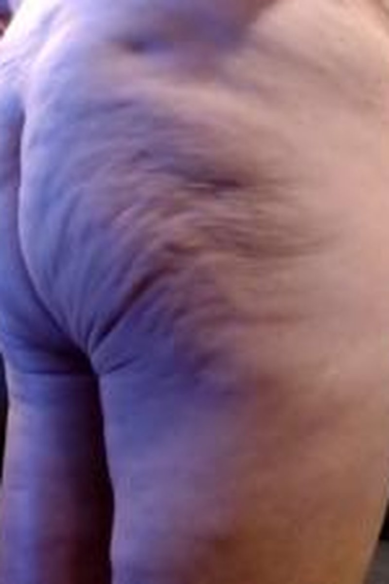 Puckered Bootie Cellulite Squeeze Ass Tease - Screenshot 1 of 4 - Ass Fetish