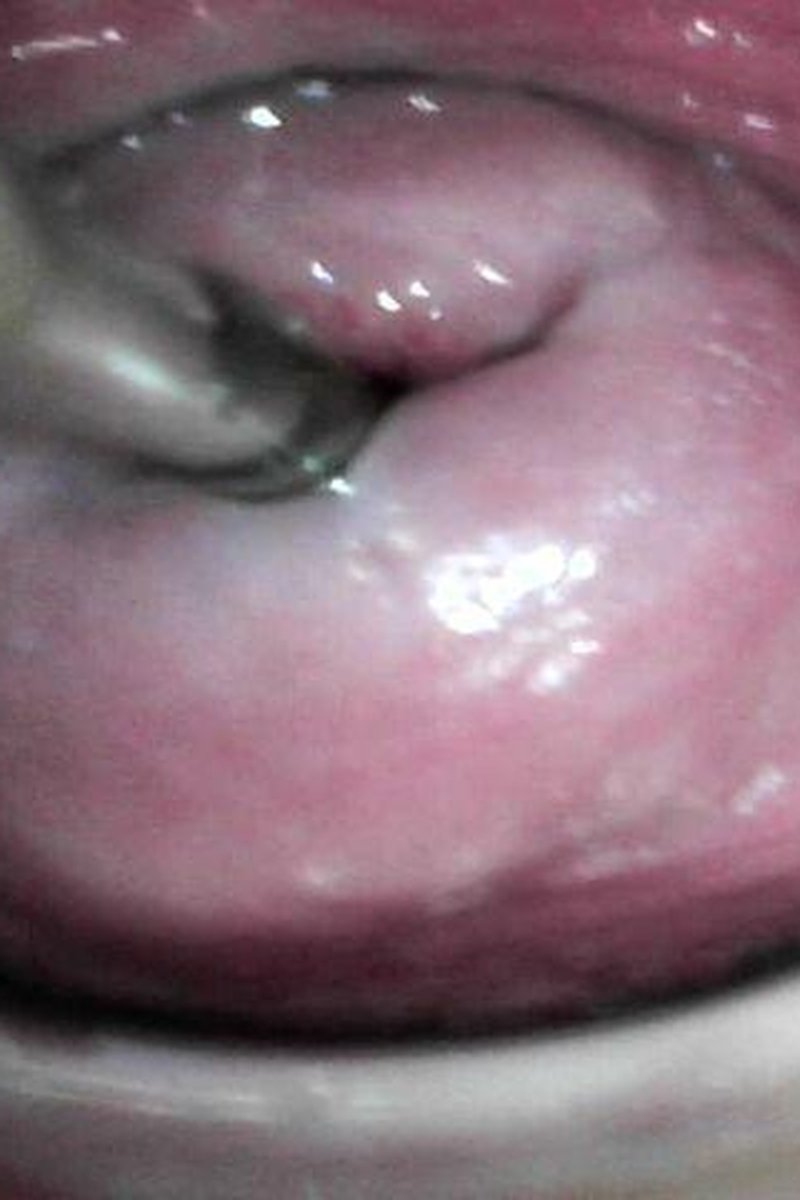 Cervix Play - Screenshot 1 of 4 - BBW