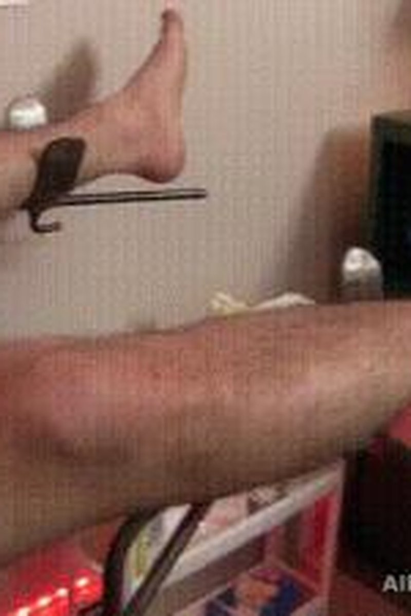 The Intern Nurses & Two Small Balls - Screenshot 1 of 4 - Domination