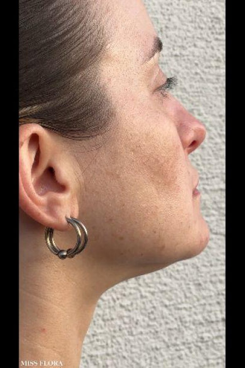 Exercising My Jaw Muscles - Screenshot 1 of 4 - Babes