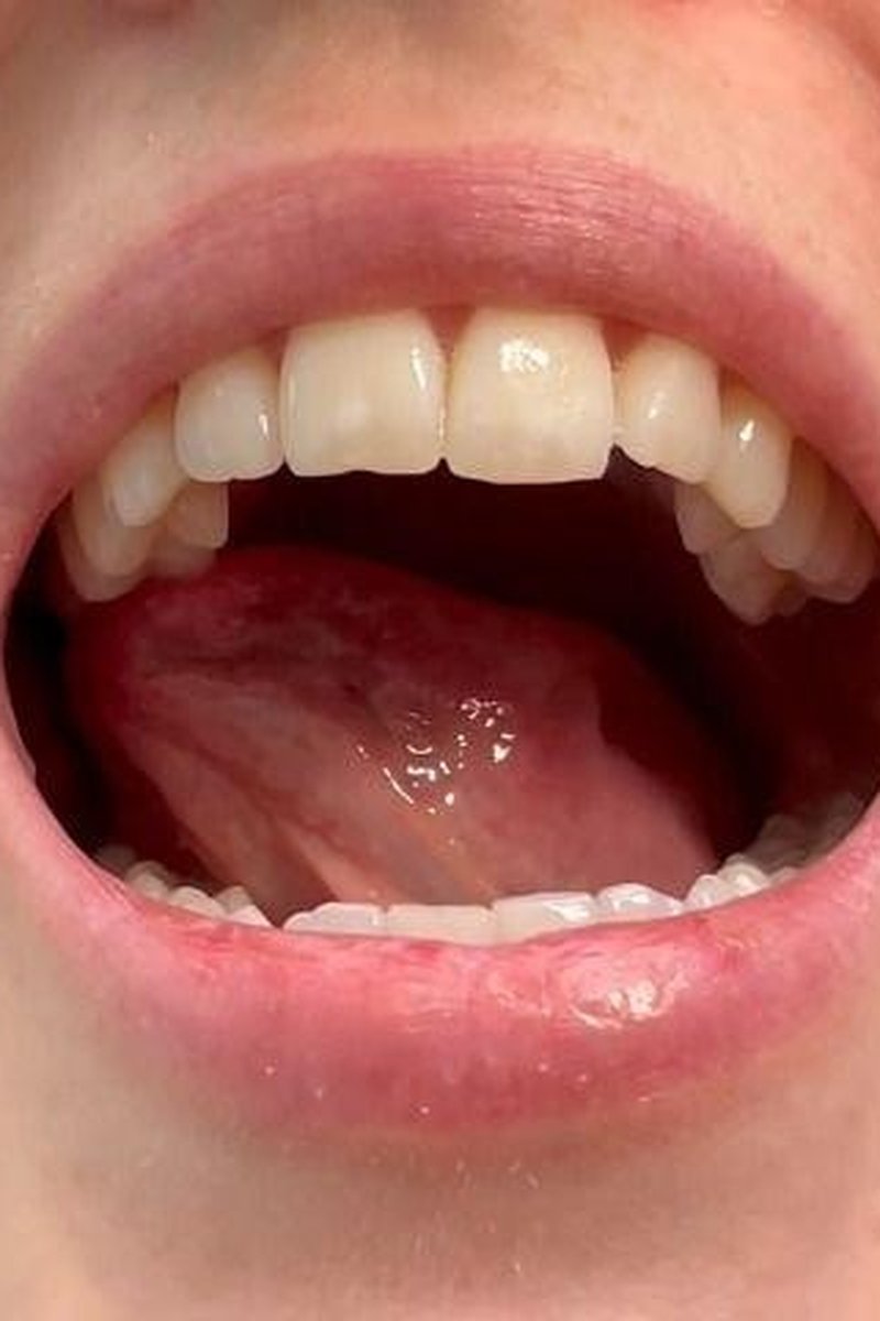 Teeth Fetish Custom - Screenshot 1 of 4 - Mouth Fetish