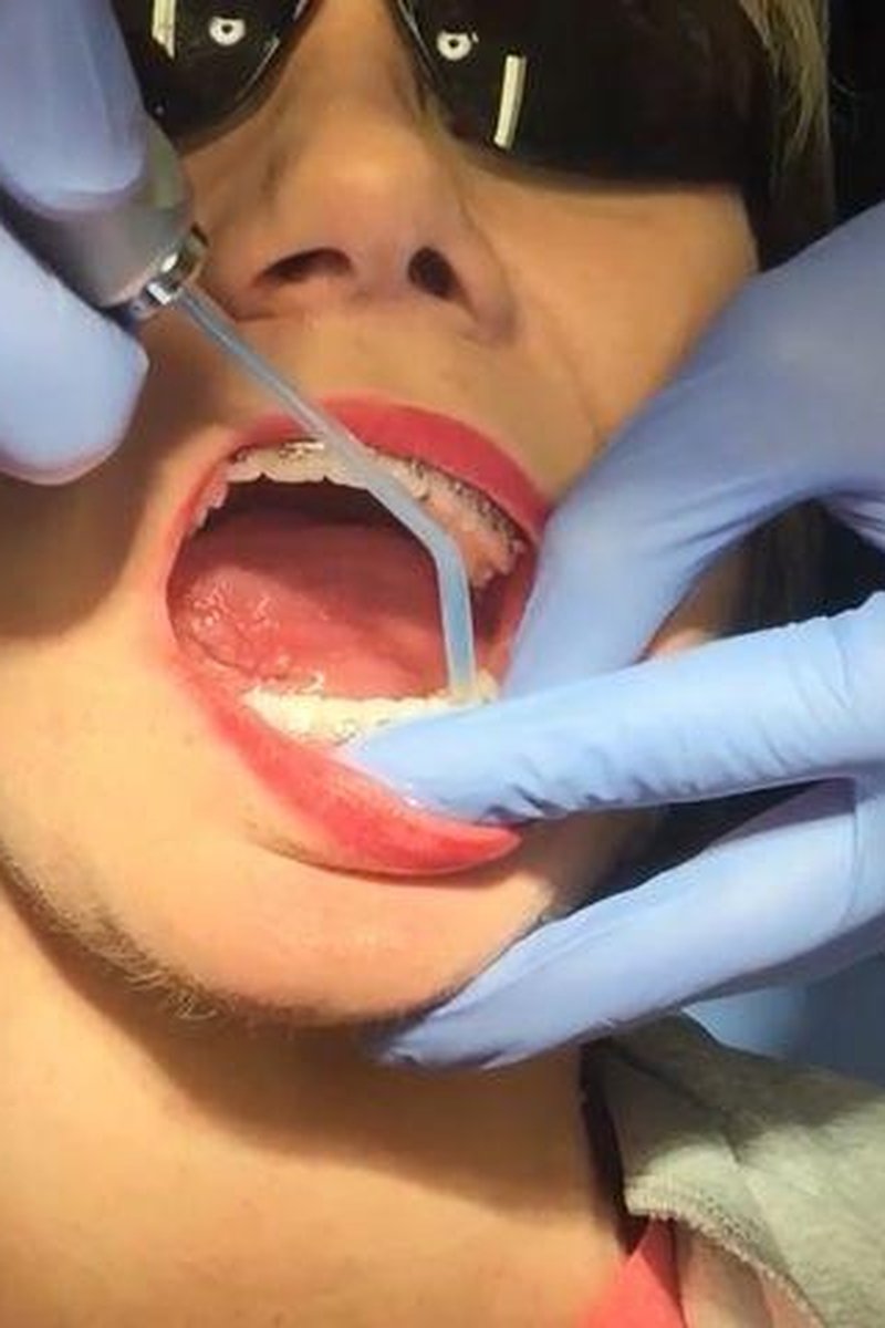 Dentist Appointment - Screenshot 1 of 4 - Braces