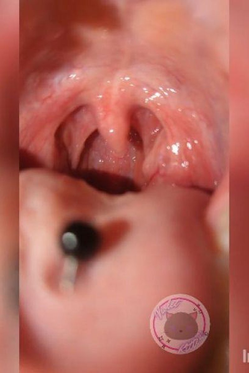 Follow The Bouncing Uvula - Screenshot 1 of 4 - Mouth Fetish