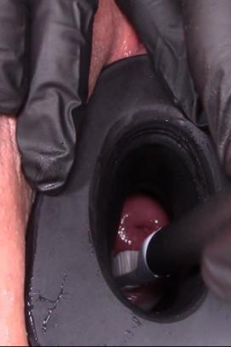 Cervix Brushing - Screenshot 1 of 4 - Gloves