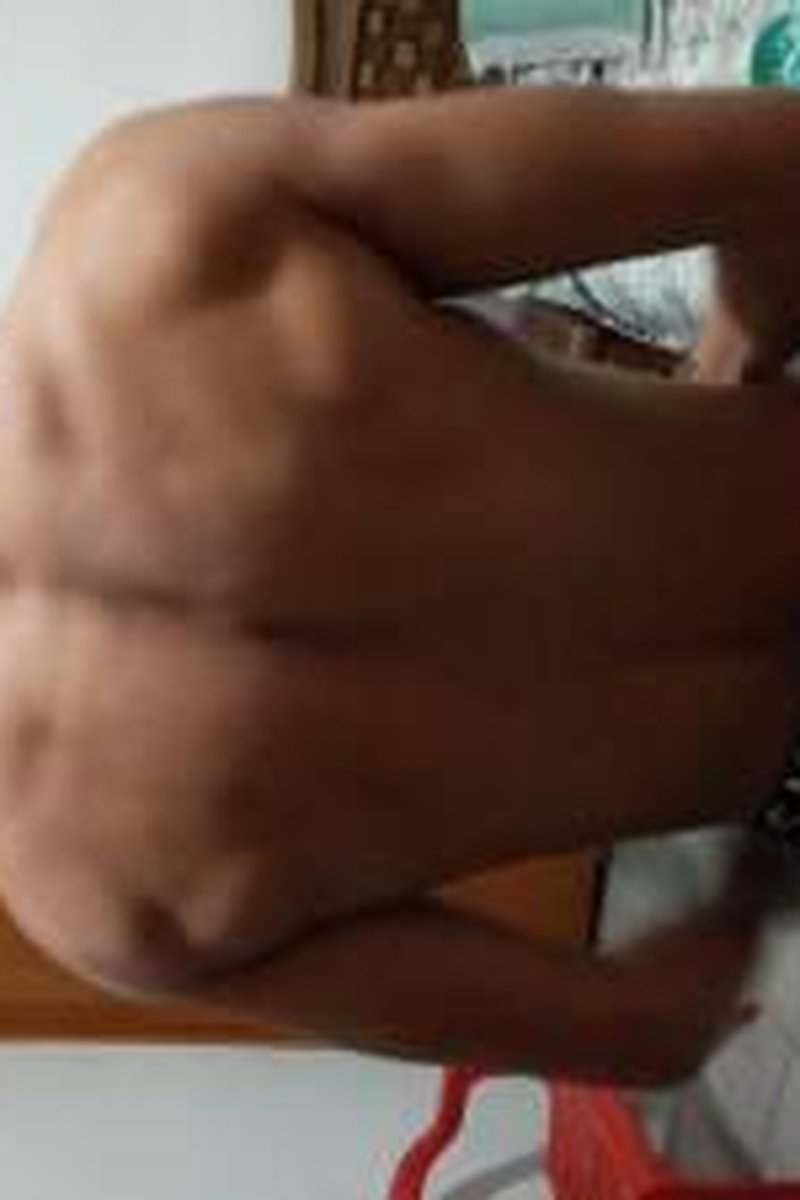 Espalda - Screenshot 1 of 4 - Teen (18-22)