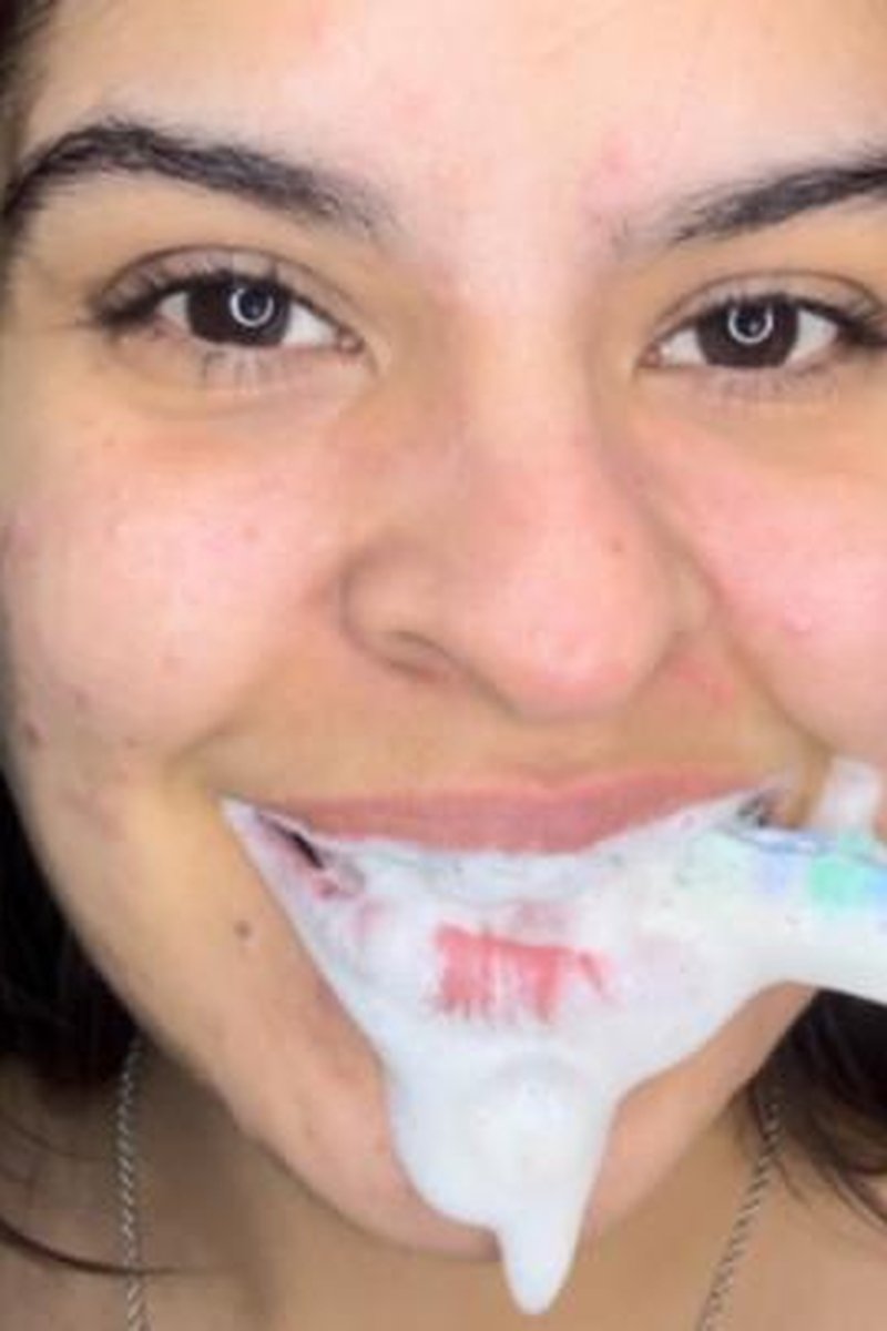 Dirty Teeth Or Clean Teeth - Screenshot 1 of 4 - Bad Breath