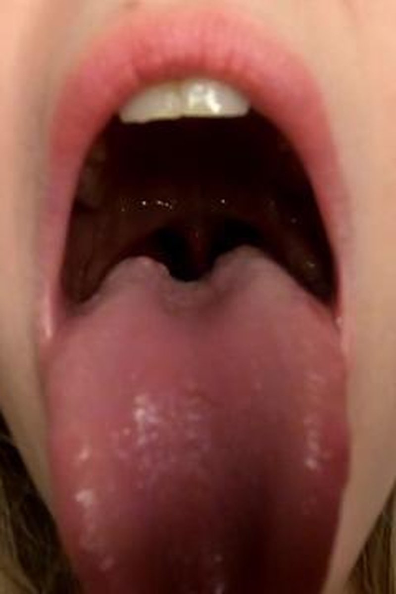 Cheers - Screenshot 1 of 4 - Asmr Mouth Sounds