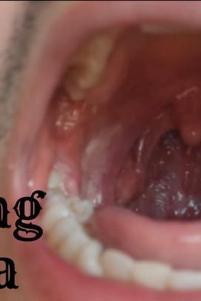 Moving Uvula - Screenshot 1 of 4 - Mouth Fetish