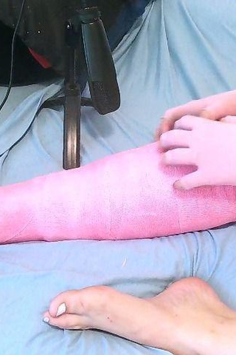 ASMR Cast Scratching - Screenshot 1 of 4 - Cast Fetish