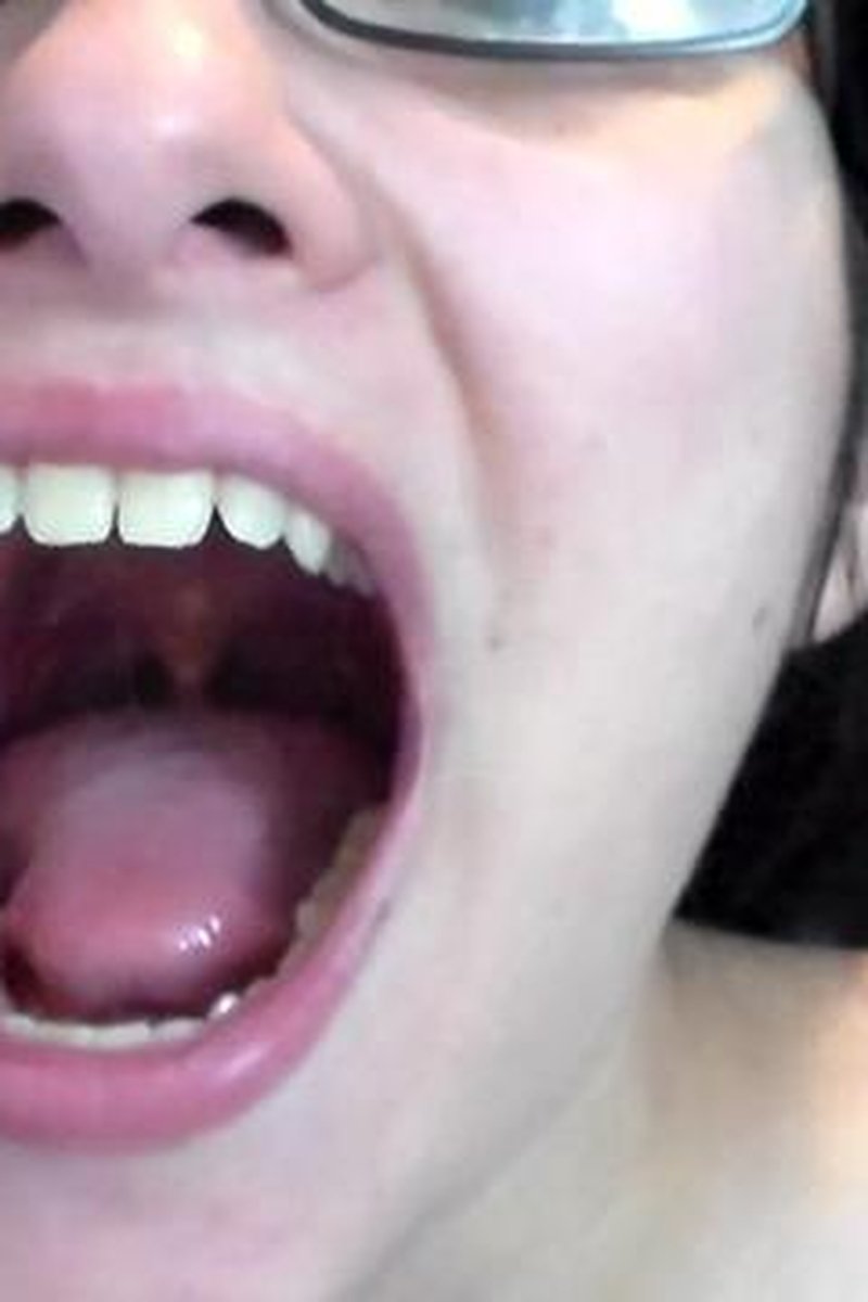 My Uvula - Screenshot 1 of 4 - Ann Sulu