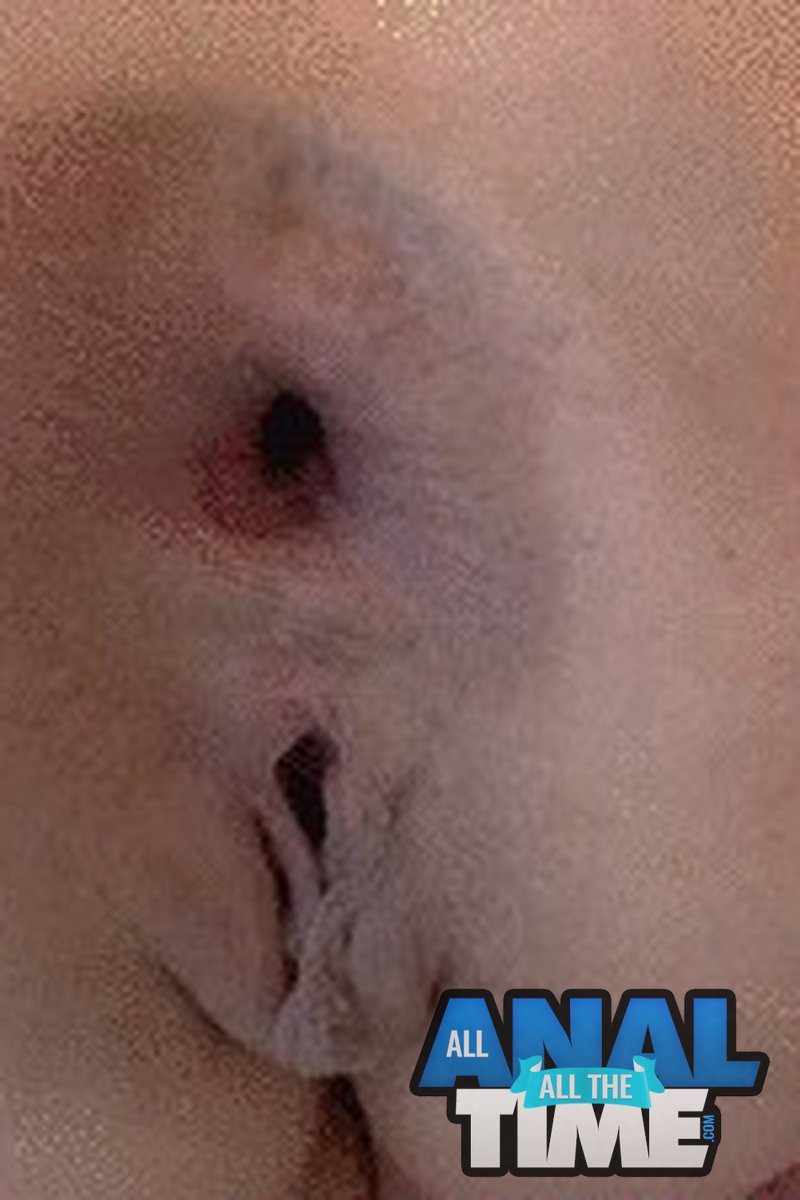 Two Big Gapers! - Screenshot 1 of 4 - Anal
