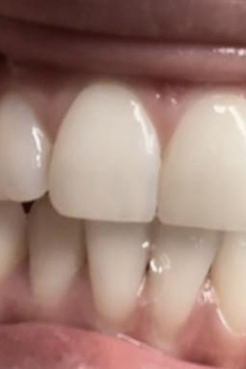 Strong Teeth & Jaws - Screenshot 1 of 4 - Face Fetish