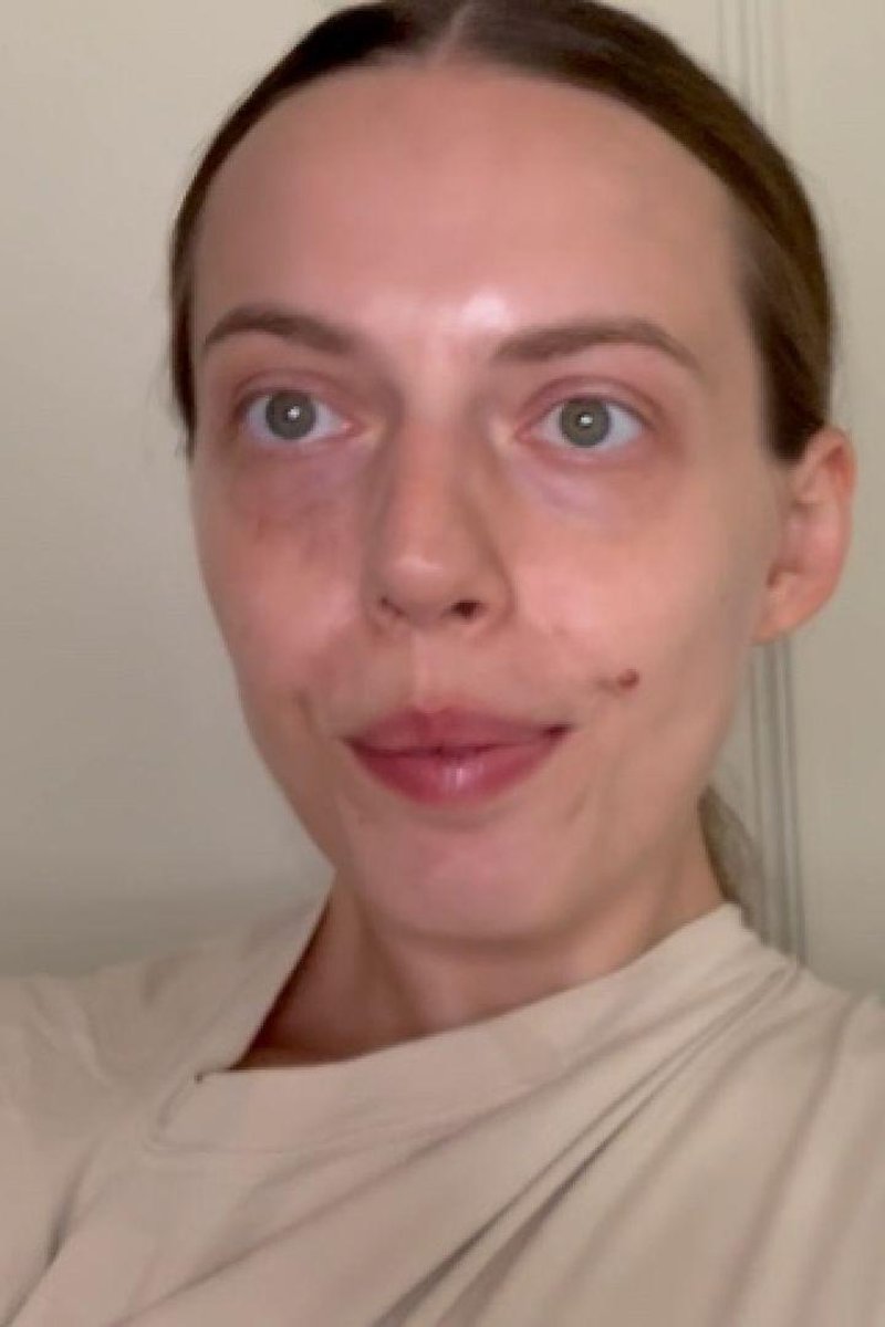 TP-manyvidschchcherry-showing-my-birthmarks-1