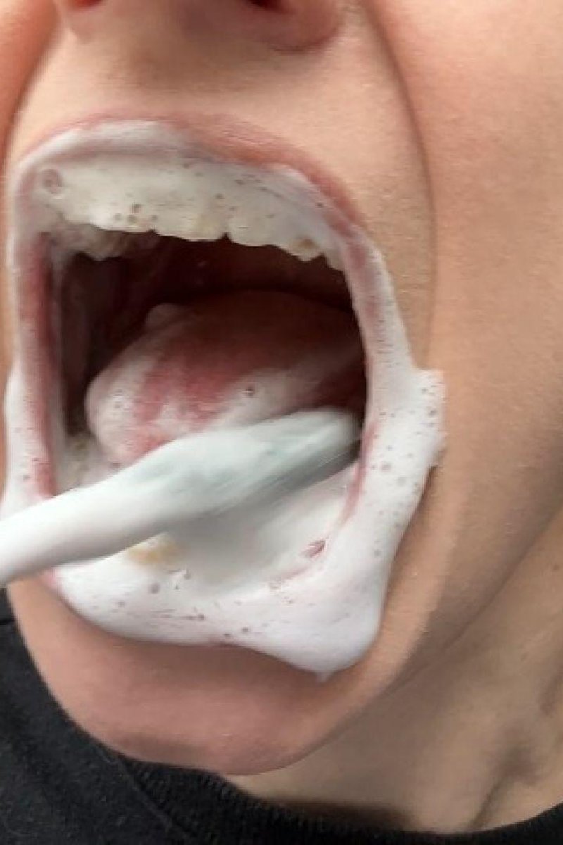 Brushing Teeth - Screenshot 1 of 4 - Badteeth