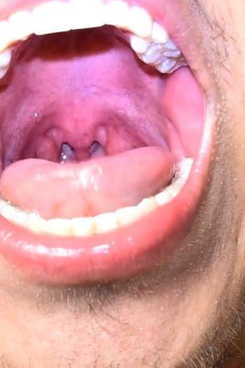 Deep Uvula - Screenshot 1 of 4 - Amateur