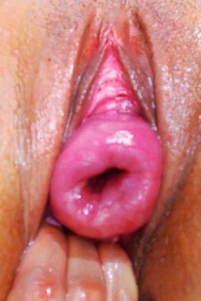 Step-Mommy Very Hot Today In Cervix - Screenshot 1 of 4 - Finger Fetish