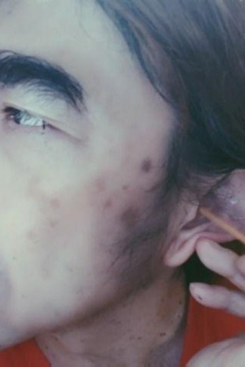 Left Ear Cleaning - Screenshot 1 of 4 - Asian