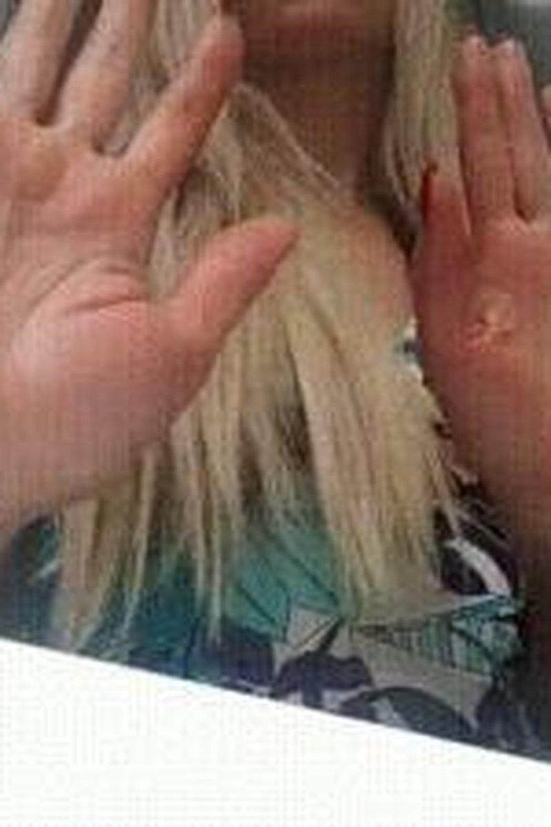 Pressed Palms - Screenshot 1 of 4 - Captive