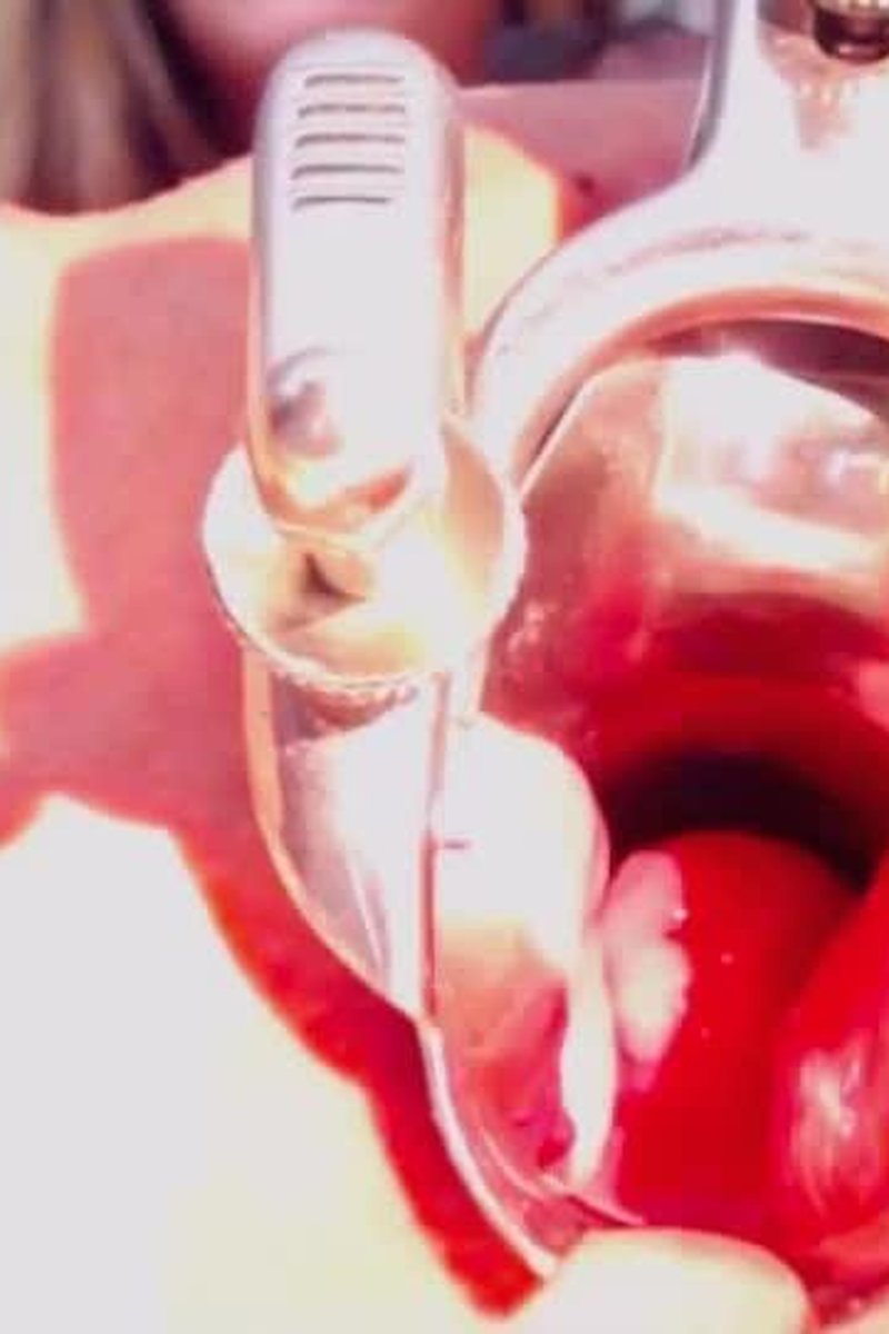 Speculum Study - Screenshot 1 of 4 - BDSM
