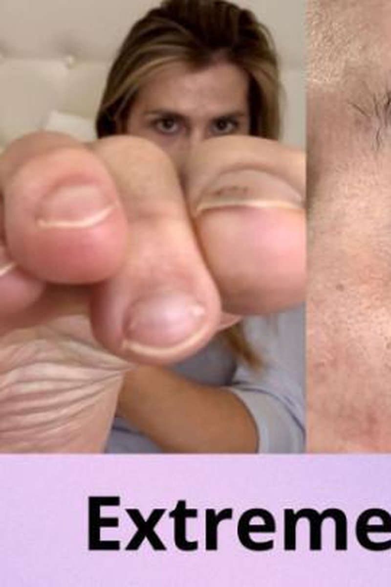 Extreme Close - Ups - Screenshot 1 of 4 - Close Up