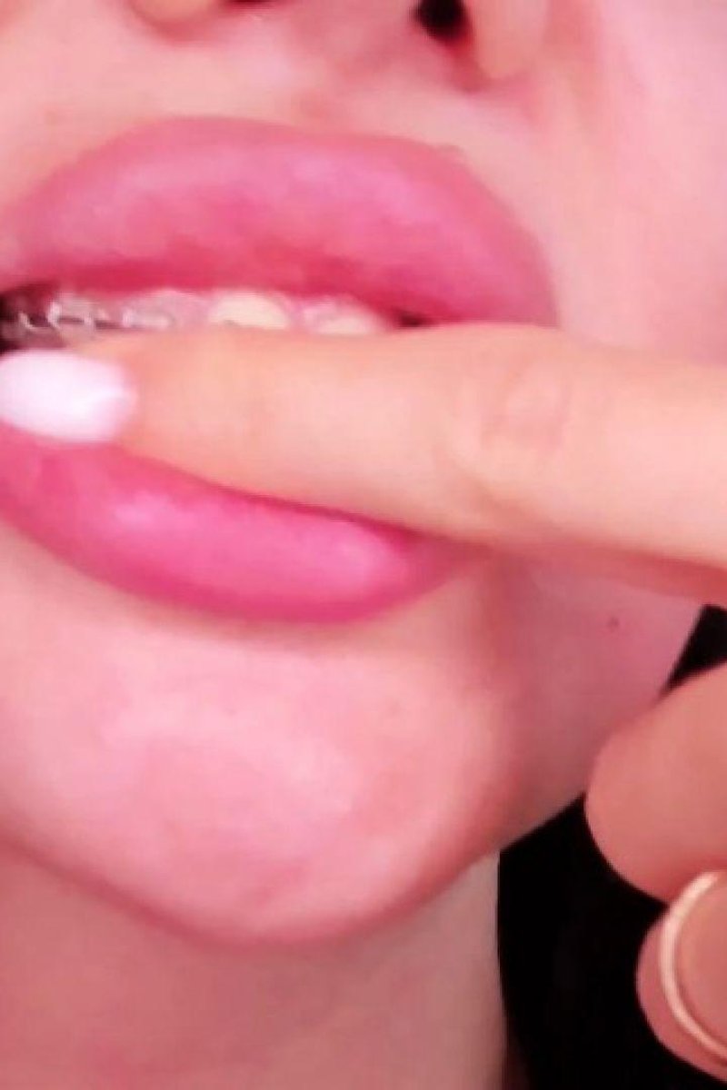 Braces Teasing - Screenshot 1 of 4 - Blowjob