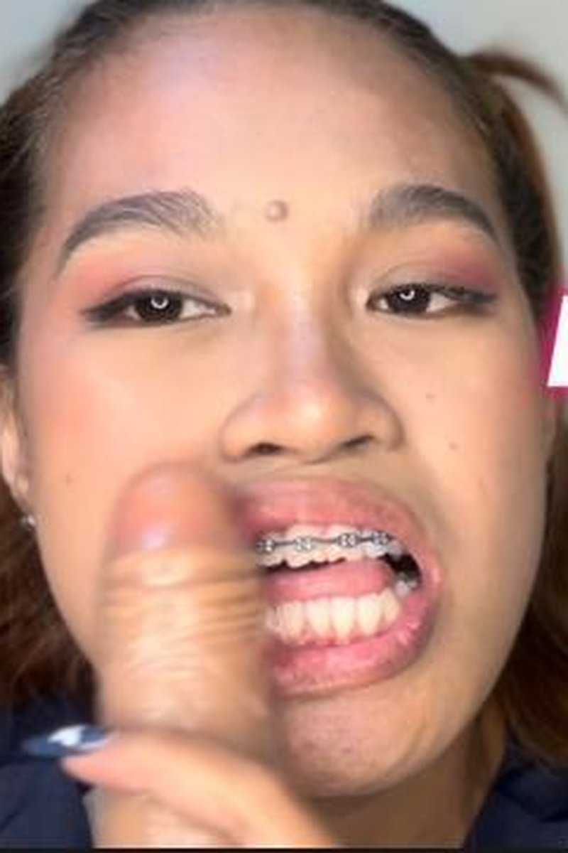 Braceface Pet - Screenshot 1 of 4 - Asian