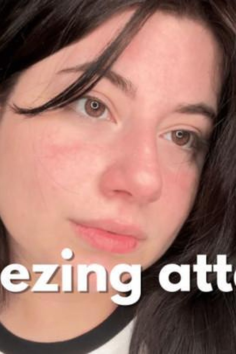 Sneezing Attack - Screenshot 1 of 4 - Nose Fetish