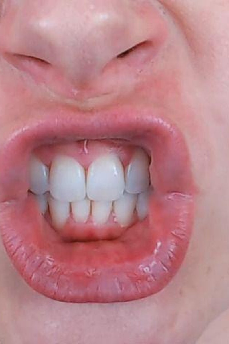 Square Lips - Screenshot 1 of 4 - Blonde Hair (Female)