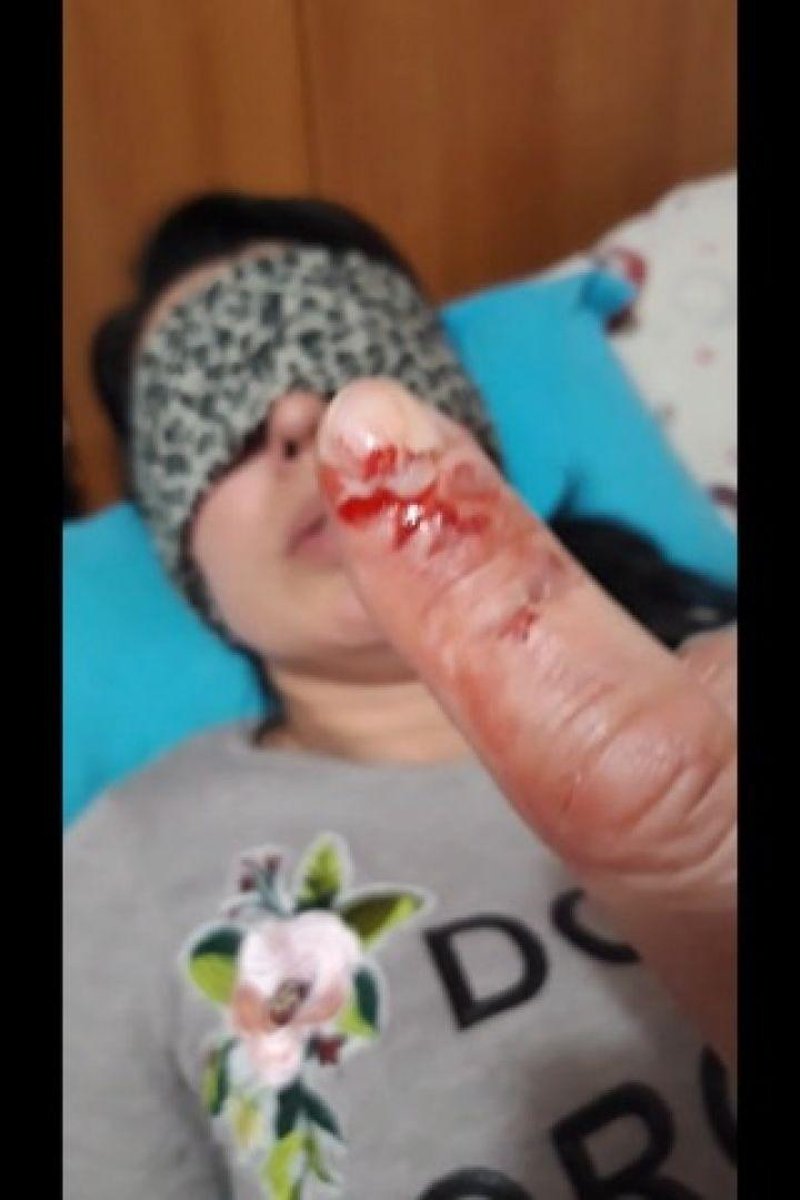 Biting 3 - Screenshot 1 of 4 - BDSM