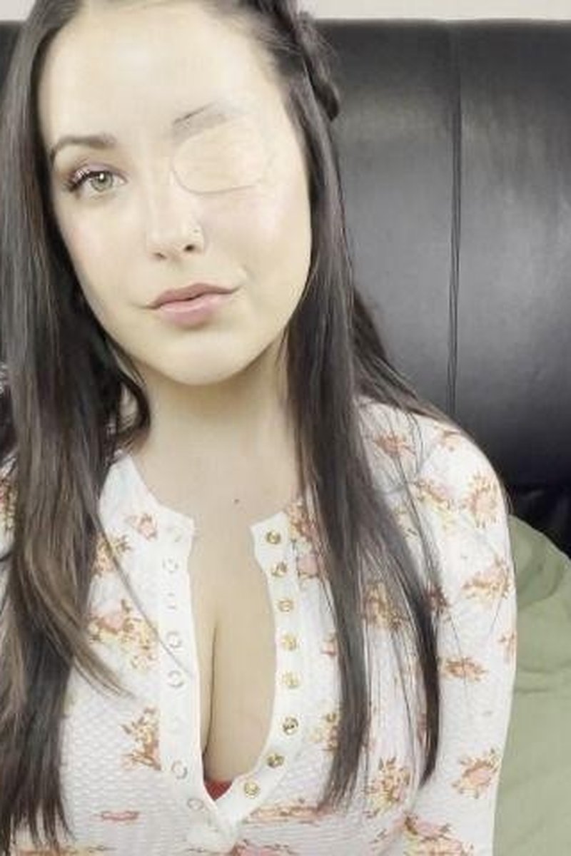 Custom: Eye Patch Fetish - Screenshot 1 of 4 - Eye Contact