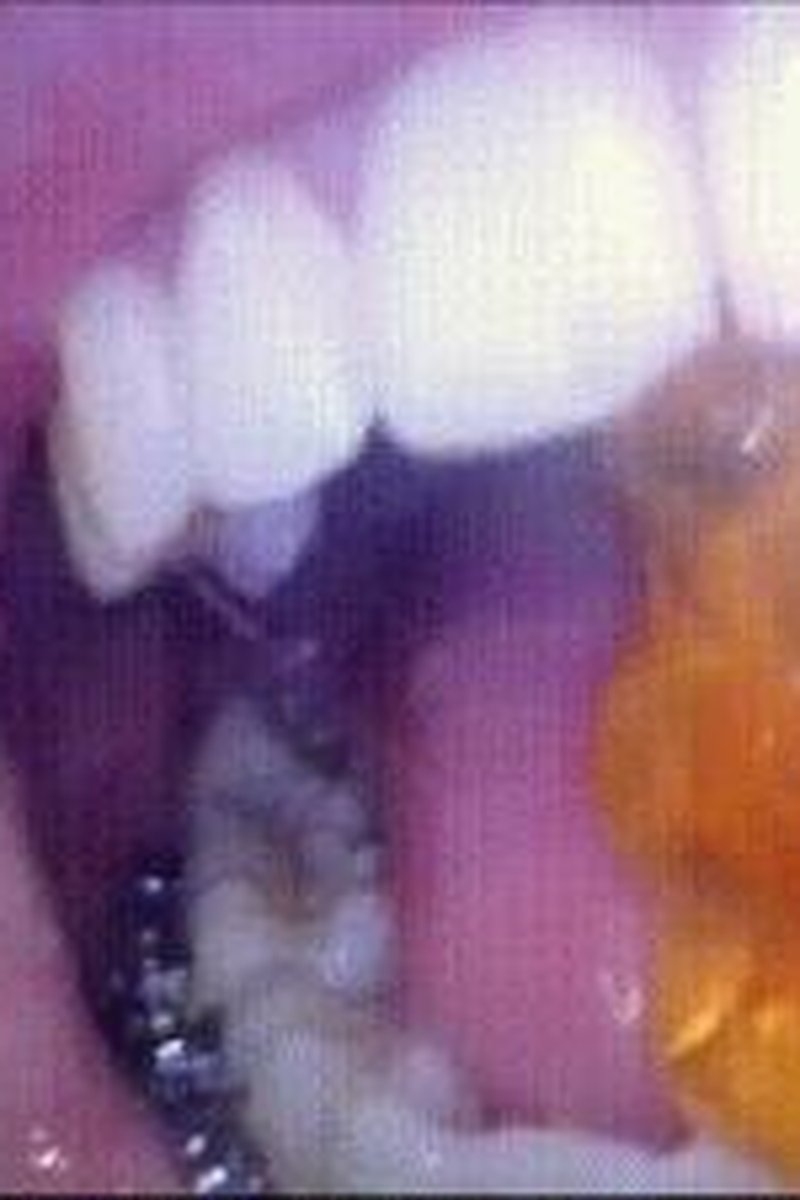 Gummy Bear Vore - Screenshot 1 of 4 - Chewing