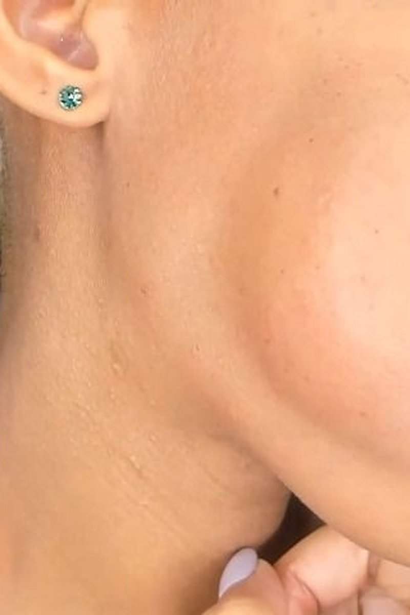 Cheek Puffing - Screenshot 1 of 4 - Black