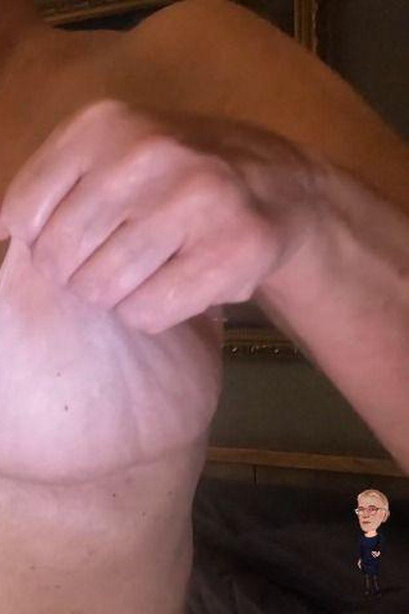 Stretch Marks Boobs - Screenshot 1 of 4 - Close Up