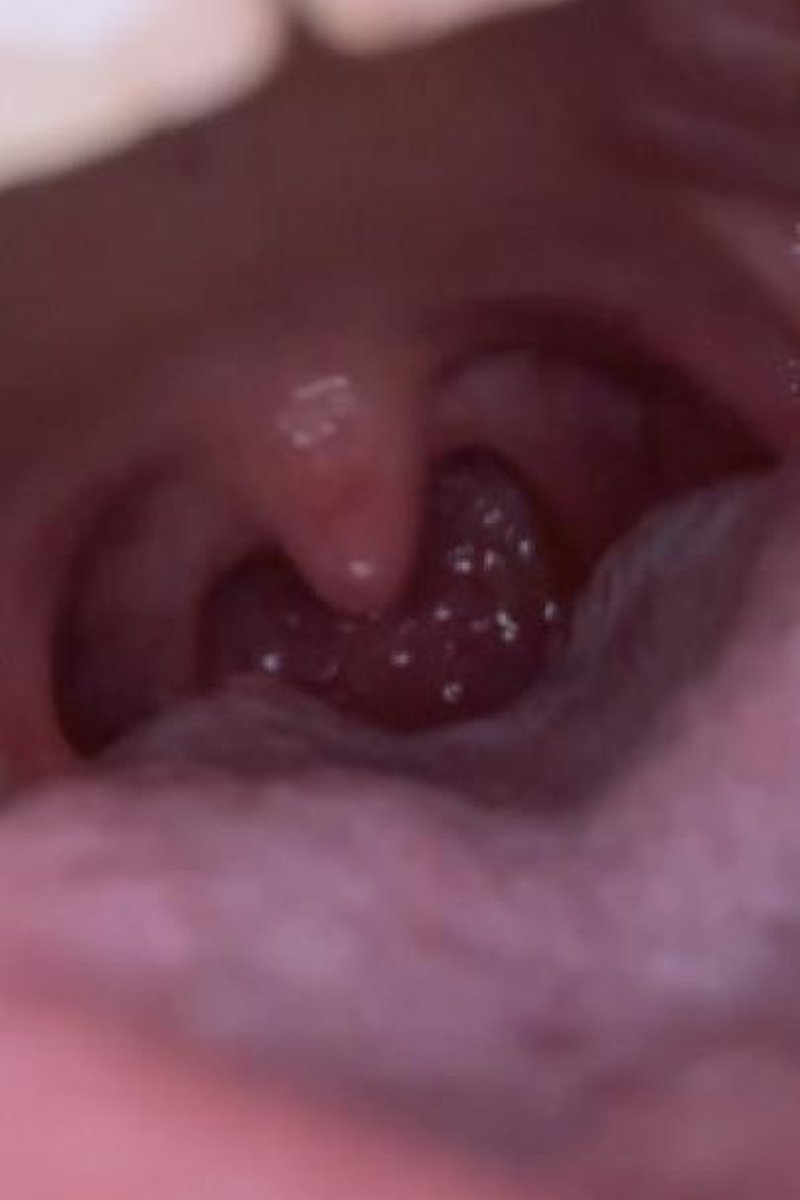 I Open Wide - Screenshot 1 of 4 - Fetish