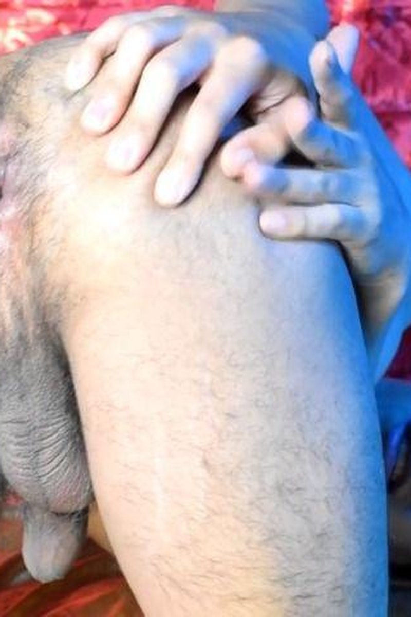 Anus Explosion - Screenshot 1 of 4 - Anal