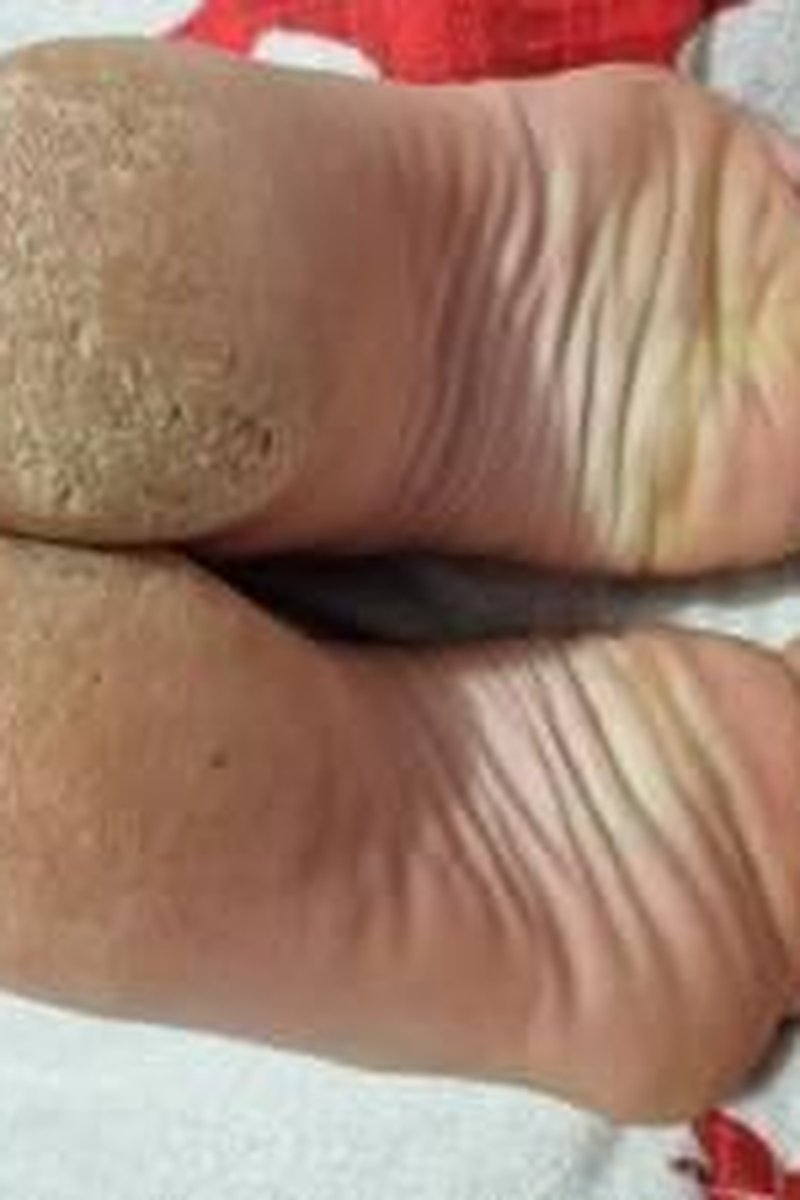Long Toenails - Screenshot 1 of 4 - Foot Fetish