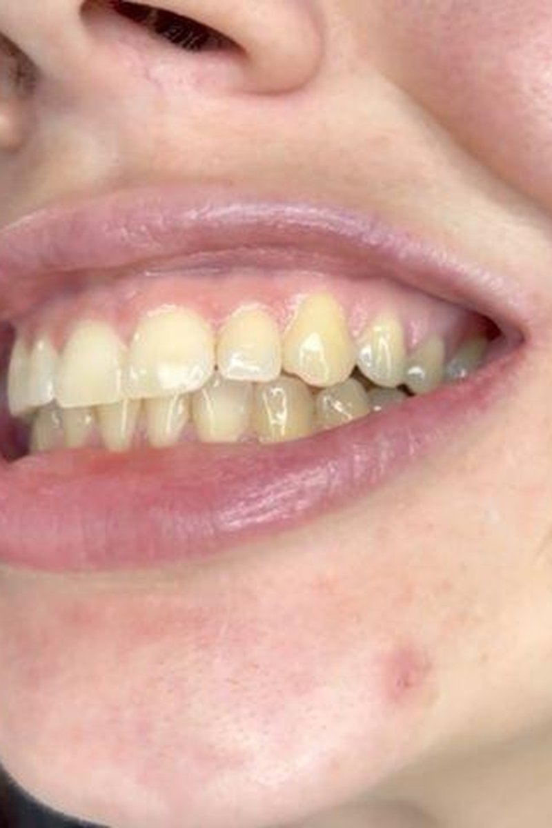 Teeth Fetish Up Close Mouth Tour - Screenshot 1 of 4 - Biting