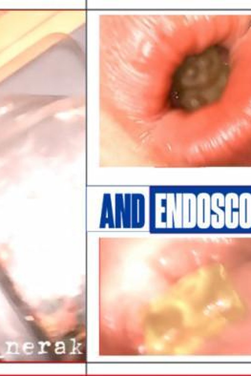 Tiny Man + Endoscope - Screenshot 1 of 4 - Tiny Man