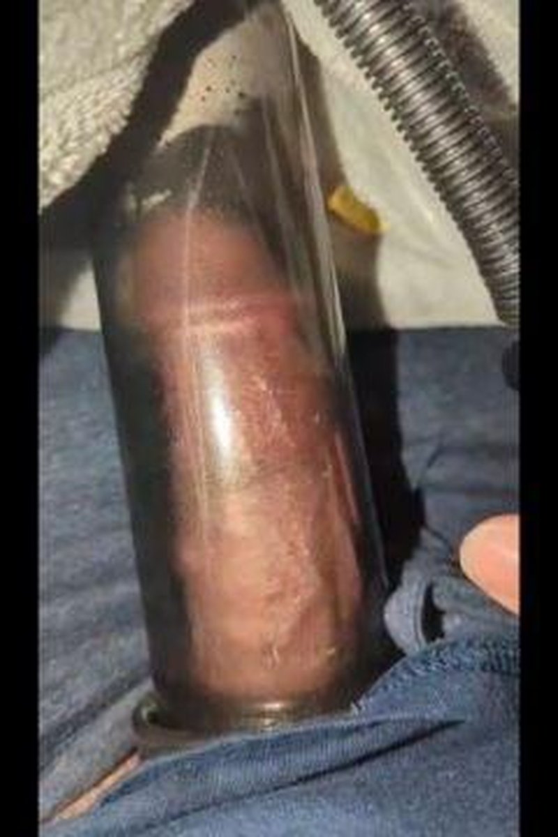 Penis Pumping - Screenshot 1 of 4 - BBC